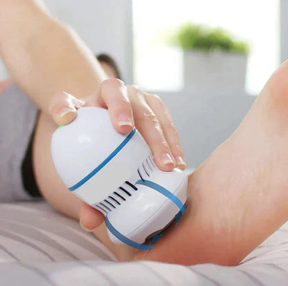 Holliroo Vacuum Callus Remover