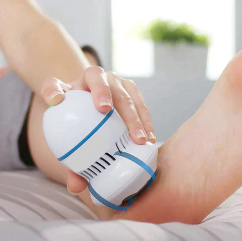 Holliroo Vacuum Callus Remover